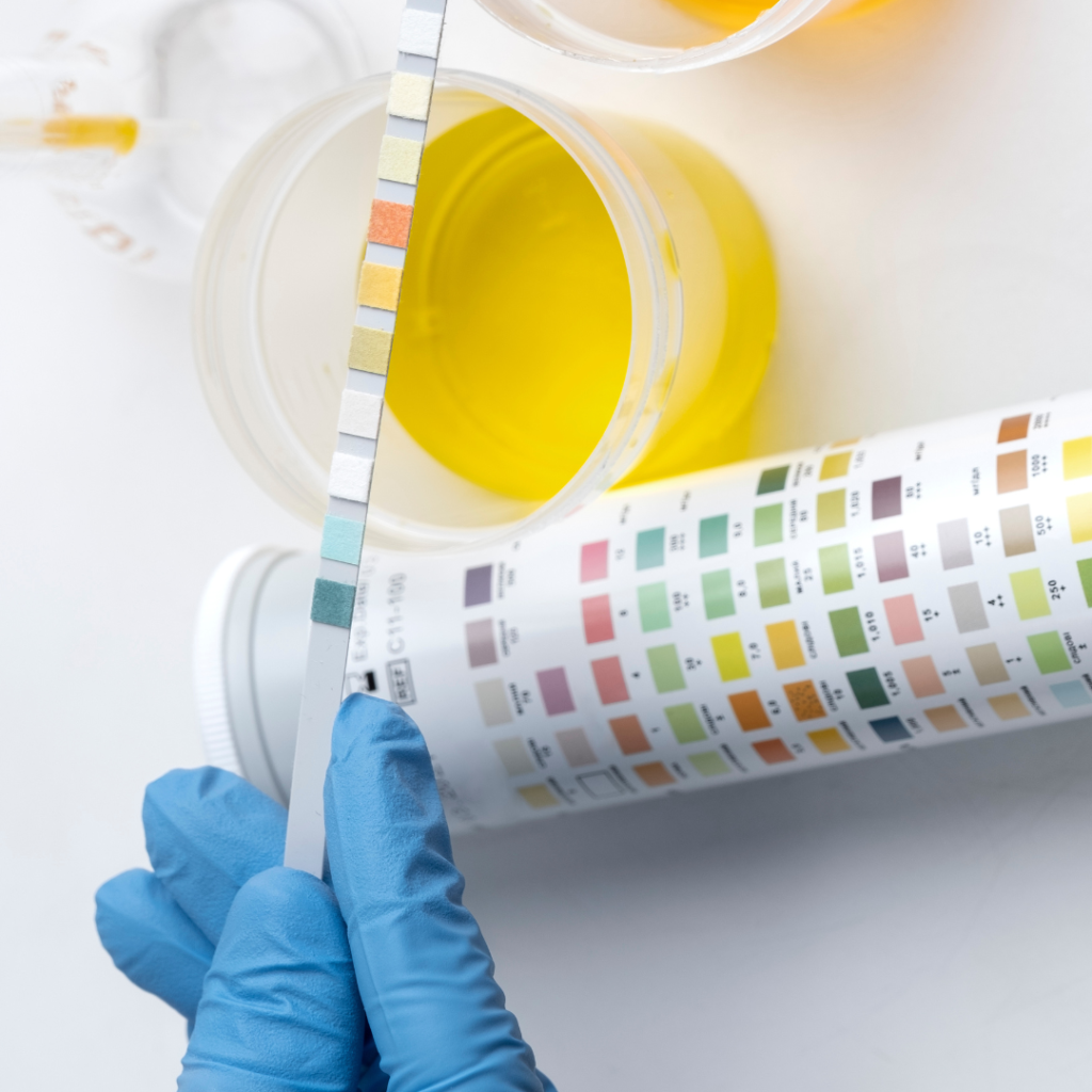 What Your Urine Colour Says About Your Health: A Guide to Decoding Urine Colour