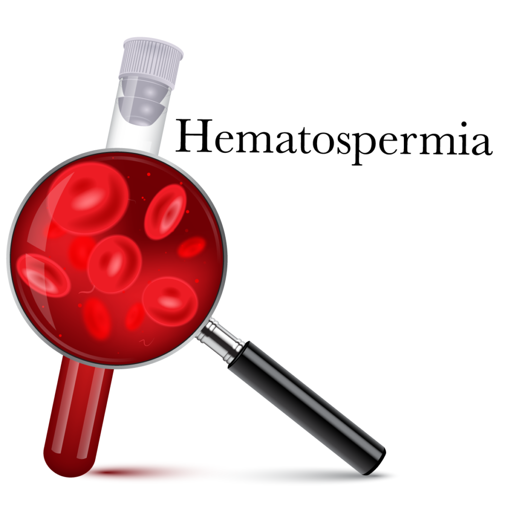 Hematospermia