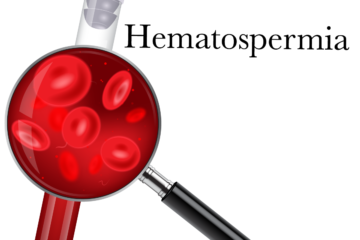 hematospermia