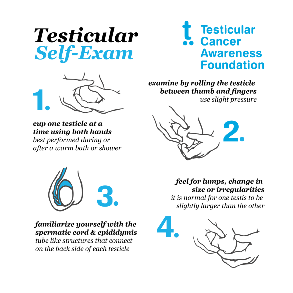 How and Why You Should Perform a Monthly Testicular Exam