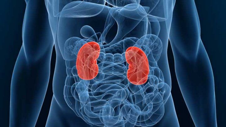 Diabetes and Chronic Kidney Disease: How Diabetes Can Lead to Kidney Failure