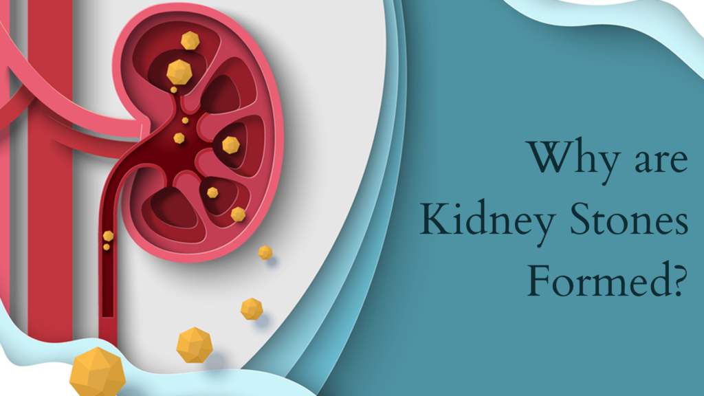 Why are Kidney Stones Formed?
